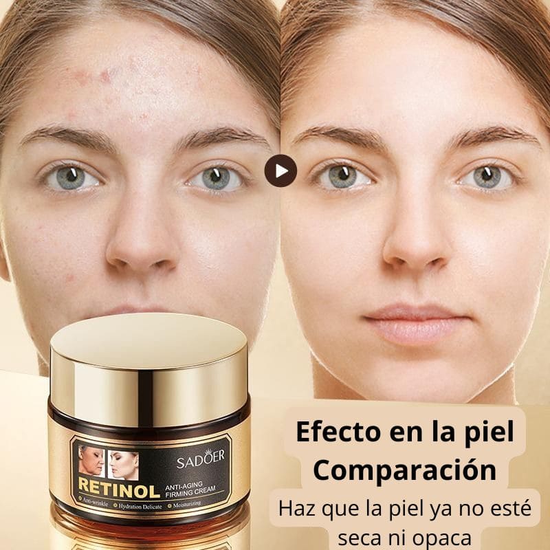 KIT Retinol Lujo: Antienvejecimiento, Antirugas, Acne, Ojeras y Oleosidad