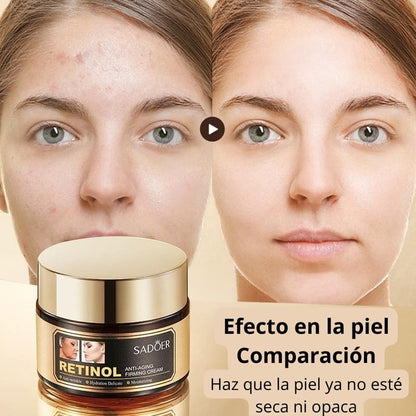 KIT Retinol Lujo: Antienvejecimiento, Antirugas, Acne, Ojeras y Oleosidad